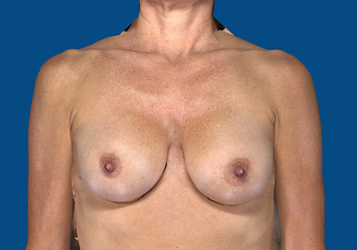 After Image