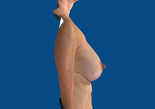 After Image