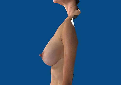 After Image
