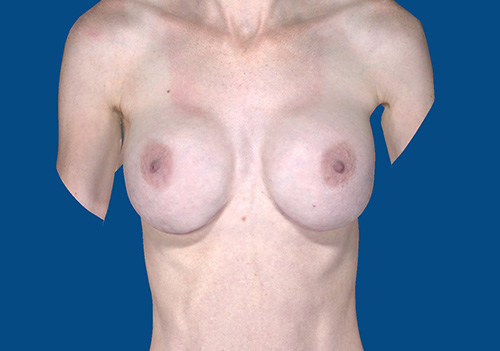 After Image