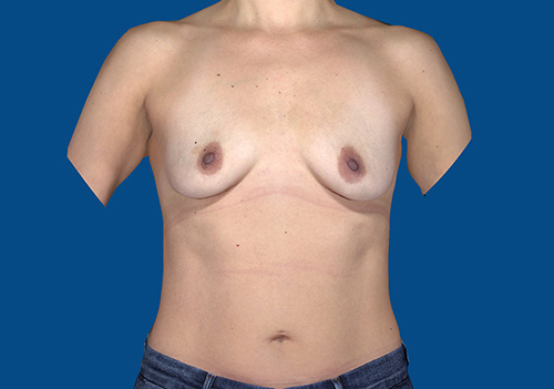 Before Image