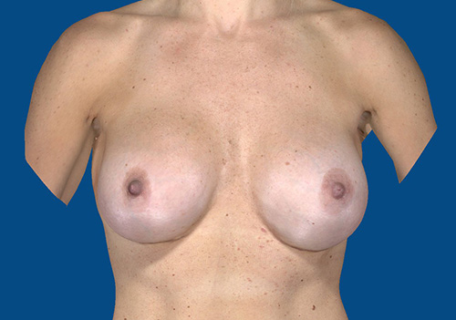 After Image