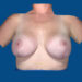 After Image