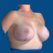 After Image