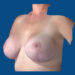 After Image