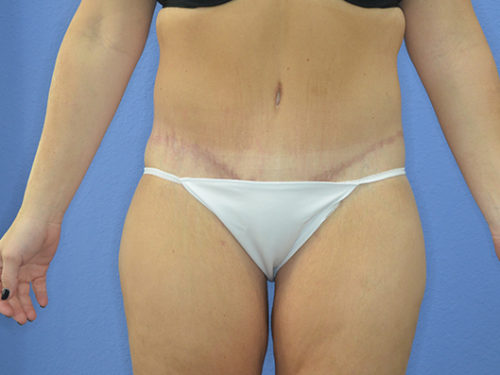 After Image