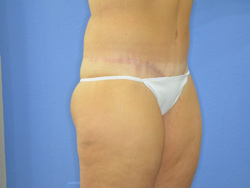 After Image