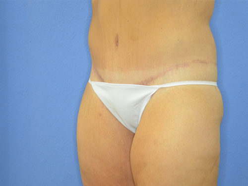 After Image