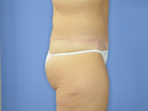 After Image