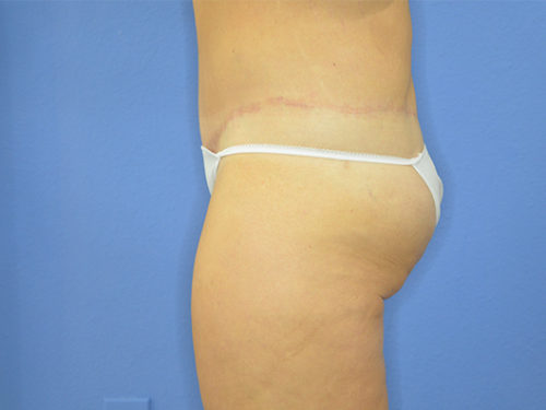 After Image