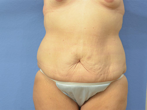 Before Image