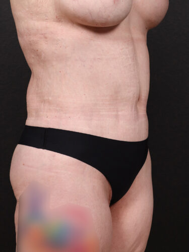 After Image