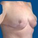 After Image