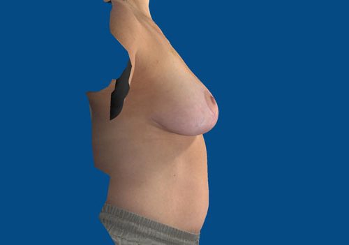 After Image