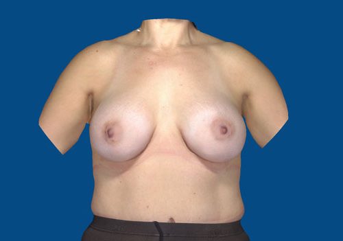 After Image