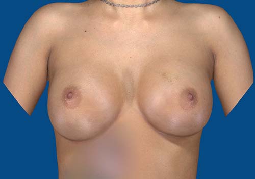 After Image