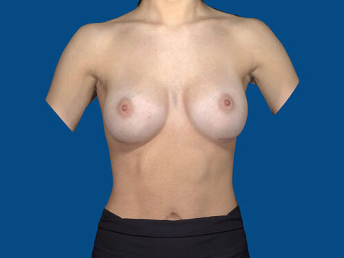 After Image