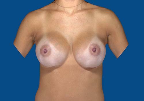 After Image