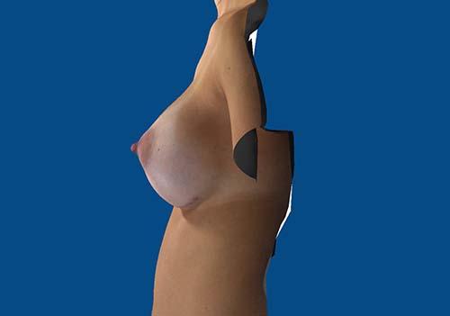 After Image