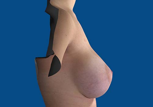 After Image