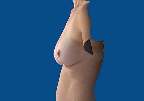 After Image