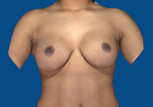 After Image