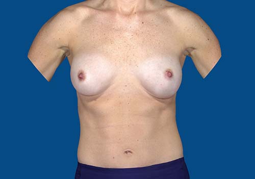 After Image
