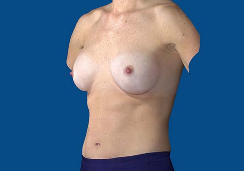 After Image