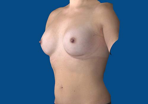 After Image
