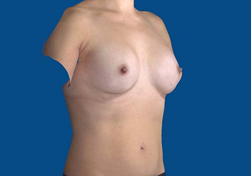 After Image