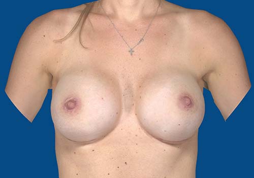 After Image