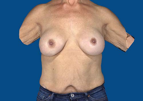 After Image