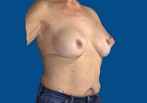 After Image