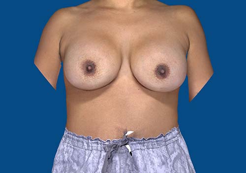 After Image