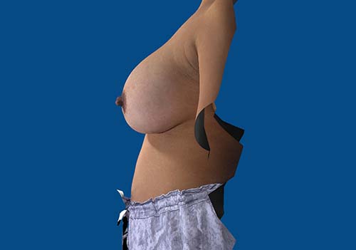 After Image