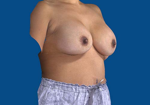 After Image