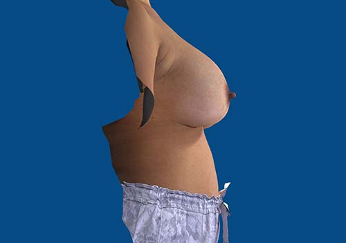 After Image