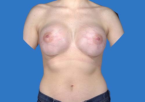 After Image