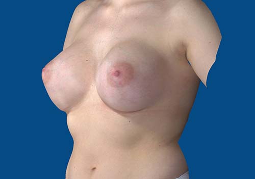 After Image