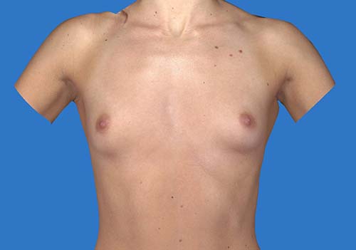 Before Image