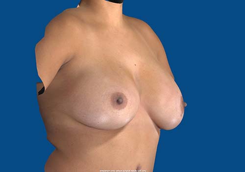 After Image