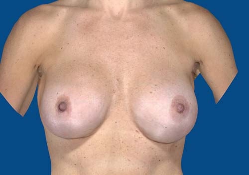 After Image