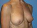 After Image