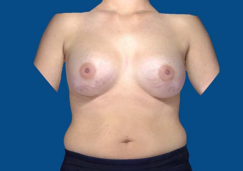 After Image