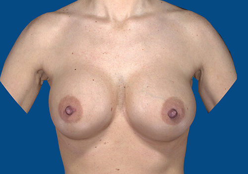 After Image