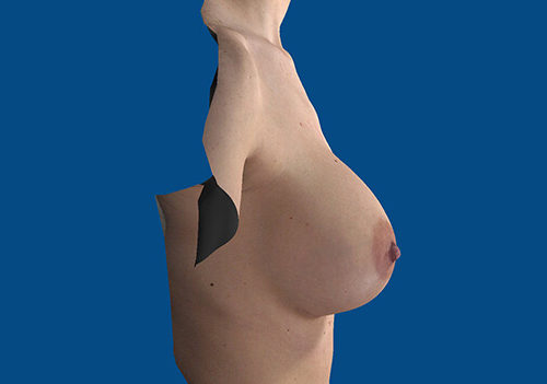 After Image