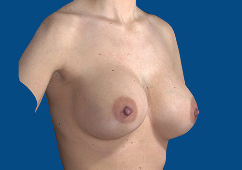 After Image
