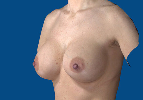 After Image