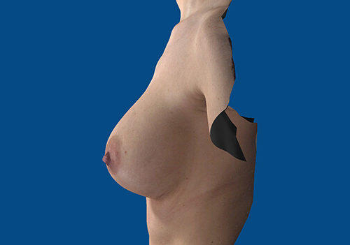 After Image