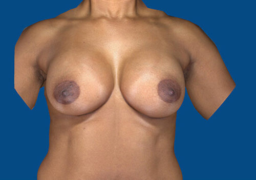 After Image
